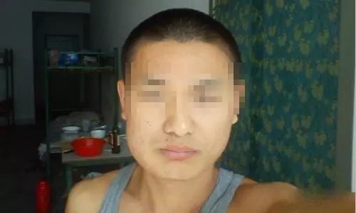 小伙嚼檳榔八年，習慣背后的臉型巨變，習慣與后果的警示故事