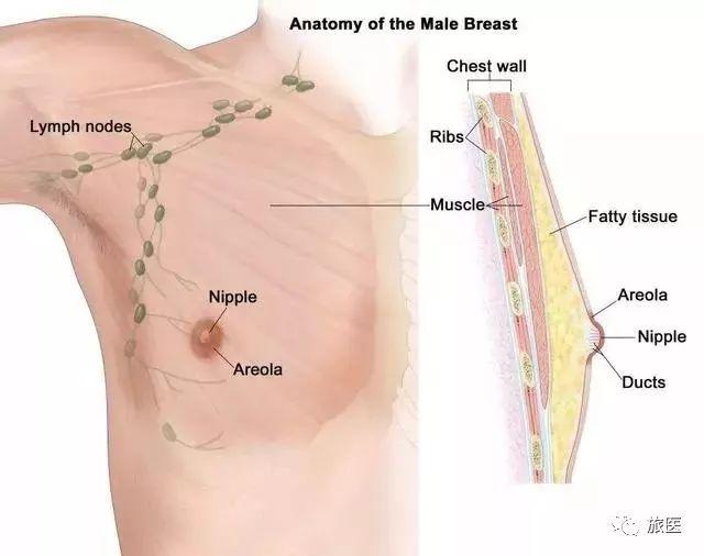 36歲女子胸部疙瘩揭示乳腺癌，早期發(fā)現(xiàn)與應(yīng)對至關(guān)重要