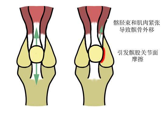 步行減輕關(guān)節(jié)壓力，健康生活的良方