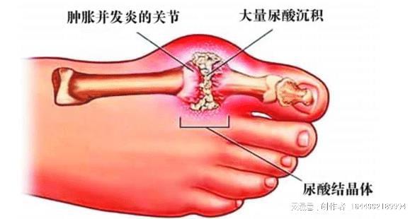 喝水促進腎臟功能與新陳代謝平衡，關鍵所在