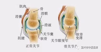 適量運(yùn)動(dòng)對(duì)骨骼長(zhǎng)期強(qiáng)度的積極影響